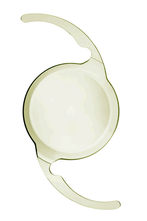 【焦点深度拡張レンズ】Tecnis Puresee（テクニスピュアシー）